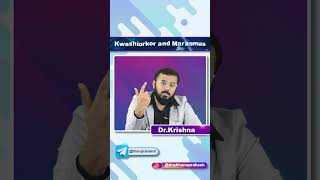 Kwashiorkor Vs Marasmus  Quick Bites [upl. by Holbrooke]