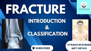 FRACTURE  INTRODUCTION amp CLASSIFICATION [upl. by Careaga42]