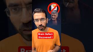 Big Brain Defect Affecting our Lives [upl. by Gone]