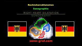 Echokardiographie  Rechtsherzdilatation [upl. by Misaq]