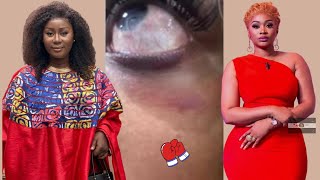 🛑Rebondissement  La Vérité Cachée Derrière lAltercation Entre Eunice Zunon amp Shavi Gomez😱 [upl. by Lacie]