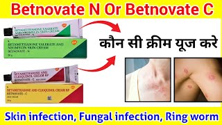 Skin Cream ll Difference between Betnovate N and Betnovate C cream ll How to use Betnovate N ll [upl. by Judd]