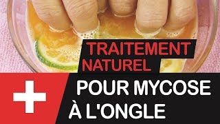 5 astuces naturelles pour soulager une mycose à longle podcast [upl. by Leuas310]