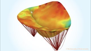 Enigma of anterior mitral leaflet movement [upl. by Hcahsem]