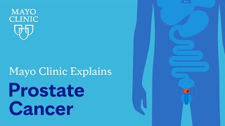 Mayo Clinic Explains Prostate Cancer [upl. by Eniale]