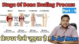 Bone fractures healing process  Fracture bone healing time  Fracture bone Repair  in Hindi [upl. by Shreve]