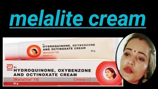 melalite  melalite cream  melalite side effects  melalite review  melasma  black spots cream [upl. by Roswald]