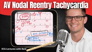 AV Nodal Reentry Tachycardia AVNRT EKG  ECG Lecture [upl. by Esmaria]