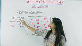 Lab Diagnosis of Hereditary Spherocytosis [upl. by Engis718]