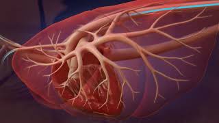 Heartworm Life Cycle for Professionals [upl. by Hasheem571]