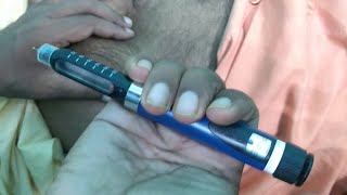 How to use Bonista pen  zotide [upl. by Ahsenet]