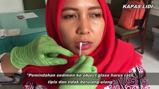 Exfoliative Cytology pada Rongga Mulut [upl. by Bergwall]