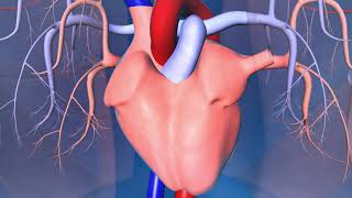 Implantable CardioverterDefibrillator ICD [upl. by Anneh]