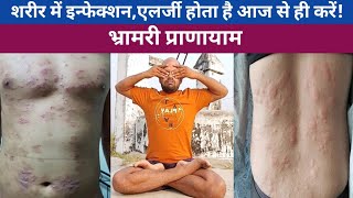 भ्रामरी प्राणायामBhramari Pranayama BenefitsBaba RamdevVijay Yogasan [upl. by Nytram]