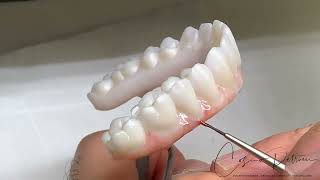 Implant Bridges Zirconia Monolithic Double Full Arch Tutorial [upl. by Ydroj955]