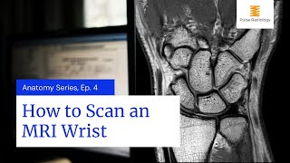 How to Scan an MRI Wrist [upl. by Yolande]