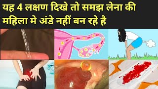 ये 4 लक्षण बताते है की महिला मे अंडे नही बन रहे।Anovulation symptoms in hindi । [upl. by Aleac]