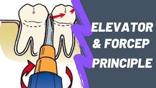 Principles of Elevator Forcep in Uncomplicated Exodontia Lever Wedge Wheel amp Axle Apexo Cryer [upl. by Dnalor]