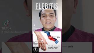 ¿Qué es flebitis Tipos de flebitis FACIL enfermería salud flebitis canalizacion 💉👨🏻‍⚕️ [upl. by Lucier]