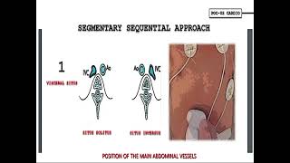 SITUS INVERSUS TOTALIS WITH DEXTROCARDIA [upl. by Annaerb]