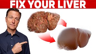 The 6 Best Ways to Heal a Fatty Liver [upl. by Naerda]