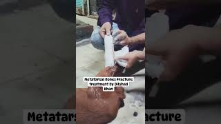 Metatarsal Bones Fracture Treatment by Dilshad Khan [upl. by Batista]