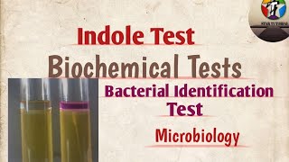 Indole test ll Biochemical Tests ll Bacterial Identification test ll Microbiology [upl. by Asiret357]