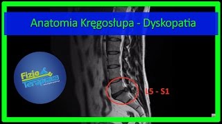 Anatomia Kręgosłupa  Dyskopatia 4 FizjoTerapia HD [upl. by Hsilgne606]