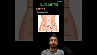 Acute cystitis SymptomsCauses amp treatmentcystitisurinarysystembladderinformationmedicalmbbs [upl. by Mariandi]