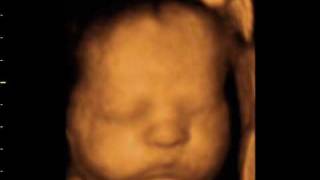 Beautiful 32wks 4D baby bonding scan [upl. by Ellary]