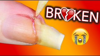 MY LIFE IS OVER I AM BROKEN  Fixing my broken nail [upl. by Llerod]