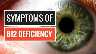 5 Signs and Symptoms of Vitamin B12 Deficiency [upl. by Anavas40]