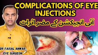 Side affects of Eye Injections  Complications of intravitreal injections eyeinjections [upl. by Vanny586]