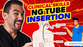 Master NG Tube Insertion A StepbyStep Clinical Skills Guide for Nurses [upl. by Harl763]