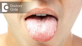 What does a white tongue in the morning mean  Dr Srivats Bharadwaj [upl. by Ateloj811]