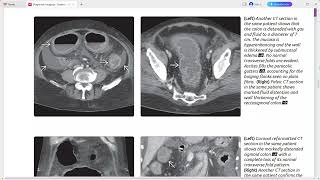 COLON DIAGNOSTIC IMAGING SERIES [upl. by Trevor82]