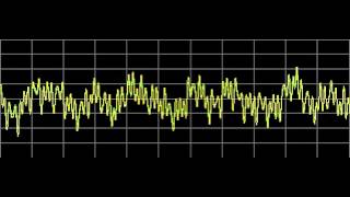 Myoclonus  Rife Frequencies [upl. by Adnilak869]