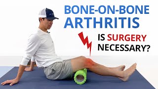 Bone on Bone Osteoarthritis Knee Pain Exercises amp Treatment Options [upl. by Eidnac]