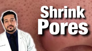 How to Shrink Pores For Good  Get Rid of Pores on Nose FAST 2021 [upl. by Airoled]