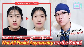 ENJPTH SUB Korean Double Jaw Surgery Case Review Facial Asymmetry [upl. by Wendy]