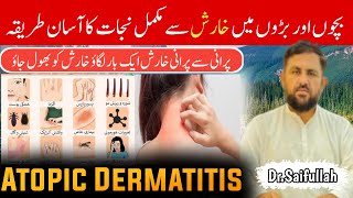 Jock itch home remedies  Jock itch treatment at home  Jock itch cream for private parts Dr saif [upl. by Oicirtap]