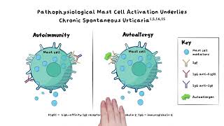 Chronic Spontaneous Urticaria Innovative Therapeutic Approaches Beyond Antihistamines [upl. by Edson149]