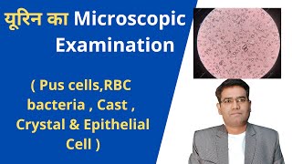 How To Do Microscopic Examination of Urine  Urine microscopy Explained  Pus cells  Rbc [upl. by Rubma]