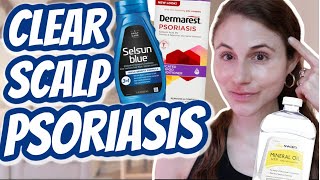 DIY Scalp Treatment for Dry Scalp  White Flakes Dandruff amp Buildup Removal [upl. by Sally]