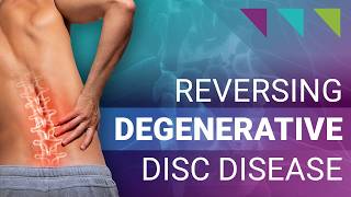 Reversing Degenerative Disc Disease [upl. by Derdle180]