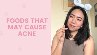 Foods That May Cause Acne  FaceTory [upl. by Acinna]