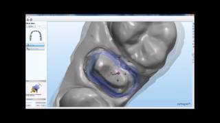 How to scan impressions and make models with 3Shape Dental System Maptec [upl. by Mona]