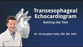 Transesophageal Echocardiogram TEE Getting the Test [upl. by Milson]