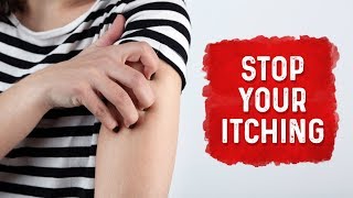 What Causes Hives and Itchiness  Urticaria Hives Treatment  Dr Berg [upl. by Matelda]