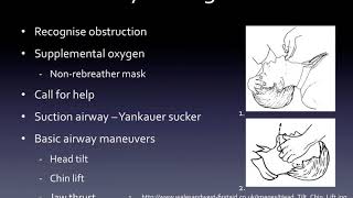 Airway management [upl. by Aliakim]